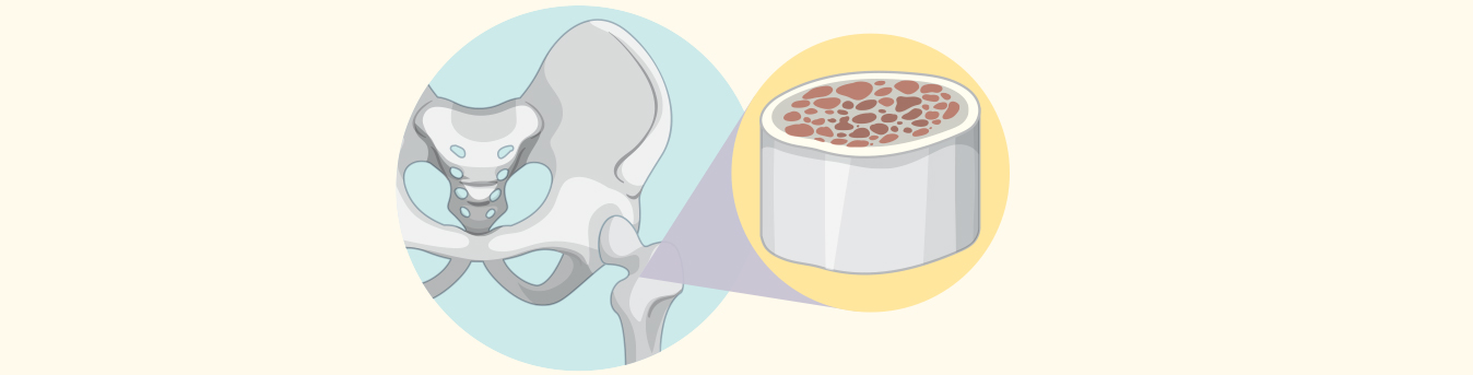 Busting some common myths about bone marrow transplant